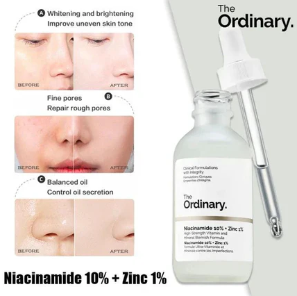 The Ordinary Niacinamide Serum 10% + Zinc 1% Supersize Serum [buy 1 Get 1 Free] | Best Quality Serum 30ml